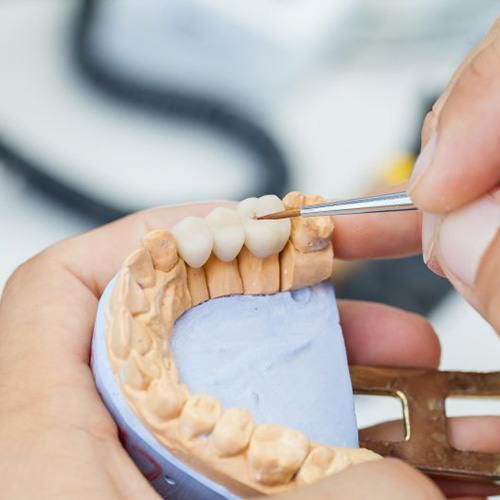 Close up of technician crafting a dental bridge