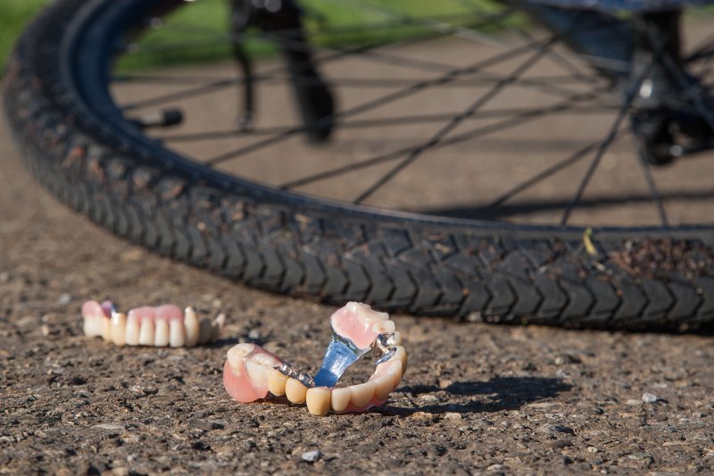 A broken denture next to a fallen bicycle
